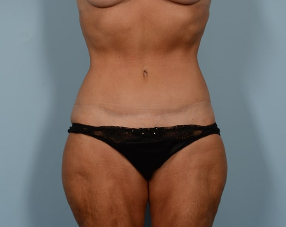 after-image