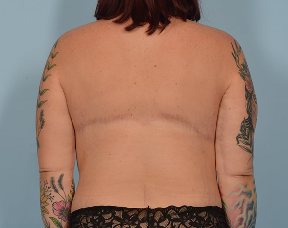 after-image