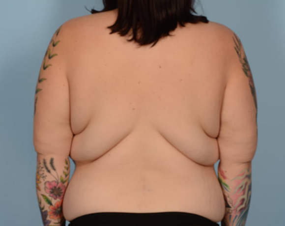 before-image