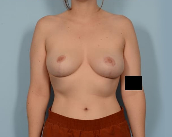 after-image