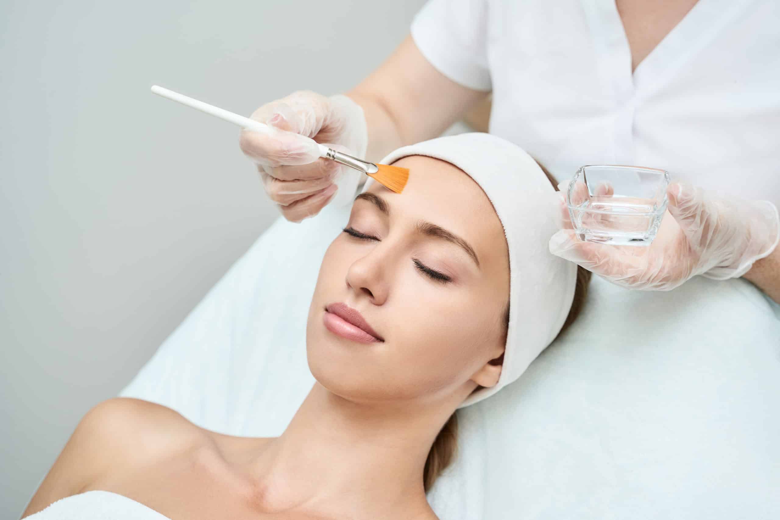 How to Care for Your Skin After a Chemical Peel Image